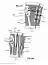 Fig. 29 - Adjustable brace assembly and methods of use
