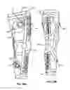 Fig. 30 - Adjustable brace assembly and methods of use