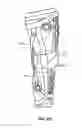 Fig. 31 - Adjustable brace assembly and methods of use