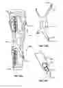 Fig. 33 - Adjustable brace assembly and methods of use