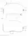 Fig. 02 - Methods and Devices for Correcting Pectus Carinatum