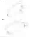 Fig. 03 - Methods and Devices for Correcting Pectus Carinatum