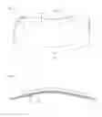 Fig. 04 - Methods and Devices for Correcting Pectus Carinatum