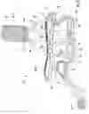 Fig. 04 - Wrist brace with enhanced lacing