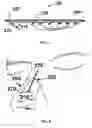 Fig. 03 - Apparatus and methods for correcting nasal valve collapse