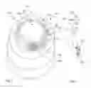 Fig. 03 - Ostomy appliance having a pre-filter and a deodorizing filter inserted into the pre-filter