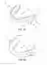 Fig. 03 - Mandibular advancement device