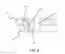 Fig. 08 - Mandibular advancement device
