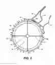 Fig. 04 - Intraocular implants and methods and kits therefor