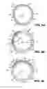 Fig. 06 - Intraocular implants and methods and kits therefor