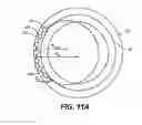 Fig. 12 - Intraocular implants and methods and kits therefor