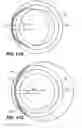 Fig. 13 - Intraocular implants and methods and kits therefor