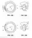 Fig. 14 - Intraocular implants and methods and kits therefor