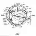 Fig. 02 - PROCESSES AND APPARATUS FOR PREVENTING, DELAYING OR AMELIORATING ONE OR MORE SYMPTOMS OF PRESBYOPIA