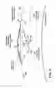 Fig. 04 - Methods of correcting vision
