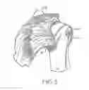 Fig. 03 - Suture sleeve patch and methods of delivery within an existing arthroscopic workflow