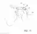 Fig. 09 - Suture sleeve patch and methods of delivery within an existing arthroscopic workflow