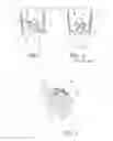 Fig. 10 - Suture sleeve patch and methods of delivery within an existing arthroscopic workflow