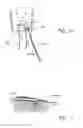 Fig. 15 - Suture sleeve patch and methods of delivery within an existing arthroscopic workflow