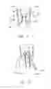 Fig. 17 - Suture sleeve patch and methods of delivery within an existing arthroscopic workflow