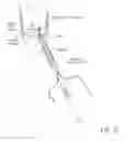 Fig. 31 - Suture sleeve patch and methods of delivery within an existing arthroscopic workflow