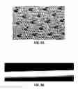Fig. 19 - Wound dressing and method of treatment