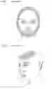 Fig. 02 - Facial structure stabilization methods and apparatus