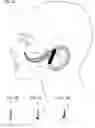 Fig. 03 - Facial structure stabilization methods and apparatus