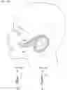 Fig. 04 - Facial structure stabilization methods and apparatus