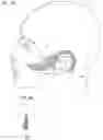 Fig. 05 - Facial structure stabilization methods and apparatus