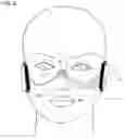 Fig. 07 - Facial structure stabilization methods and apparatus