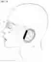 Fig. 15 - Facial structure stabilization methods and apparatus