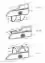 Fig. 60 - Patient support usable with bariatric patients