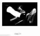 Fig. 09 - Soft tissue mobilization device
