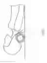 Fig. 06 - MASSAGING VIBRATION DEVICE AND MASSAGING ASSEMBLY INCLUDING SAME