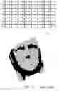 Fig. 04 - Optical techniques for the measurement of chest compression depth and other parameters during CPR
