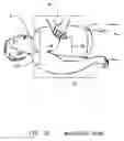 Fig. 16 - Optical techniques for the measurement of chest compression depth and other parameters during CPR