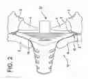 Fig. 03 - Closed system mouthpiece with light and heat generation to activate a formulation to increase its volume