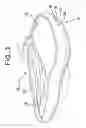 Fig. 04 - Closed system mouthpiece with light and heat generation to activate a formulation to increase its volume