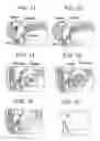 Fig. 08 - Closed system mouthpiece with light and heat generation to activate a formulation to increase its volume