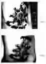 Fig. 03 - Method for treating deleterious effects arising from tattoos