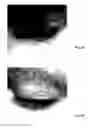Fig. 05 - Method for treating deleterious effects arising from tattoos