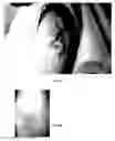 Fig. 07 - Method for treating deleterious effects arising from tattoos