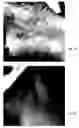 Fig. 08 - Method for treating deleterious effects arising from tattoos
