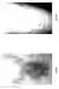 Fig. 09 - Method for treating deleterious effects arising from tattoos