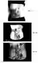 Fig. 15 - Method for treating deleterious effects arising from tattoos