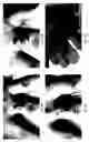 Fig. 18 - Method for treating deleterious effects arising from tattoos