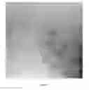 Fig. 10 - Matrix Stabilized Liposomes