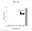 Fig. 04 - Compositions and methods for treating ewing sarcoma