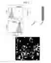 Fig. 05 - Compositions and methods for treating ewing sarcoma